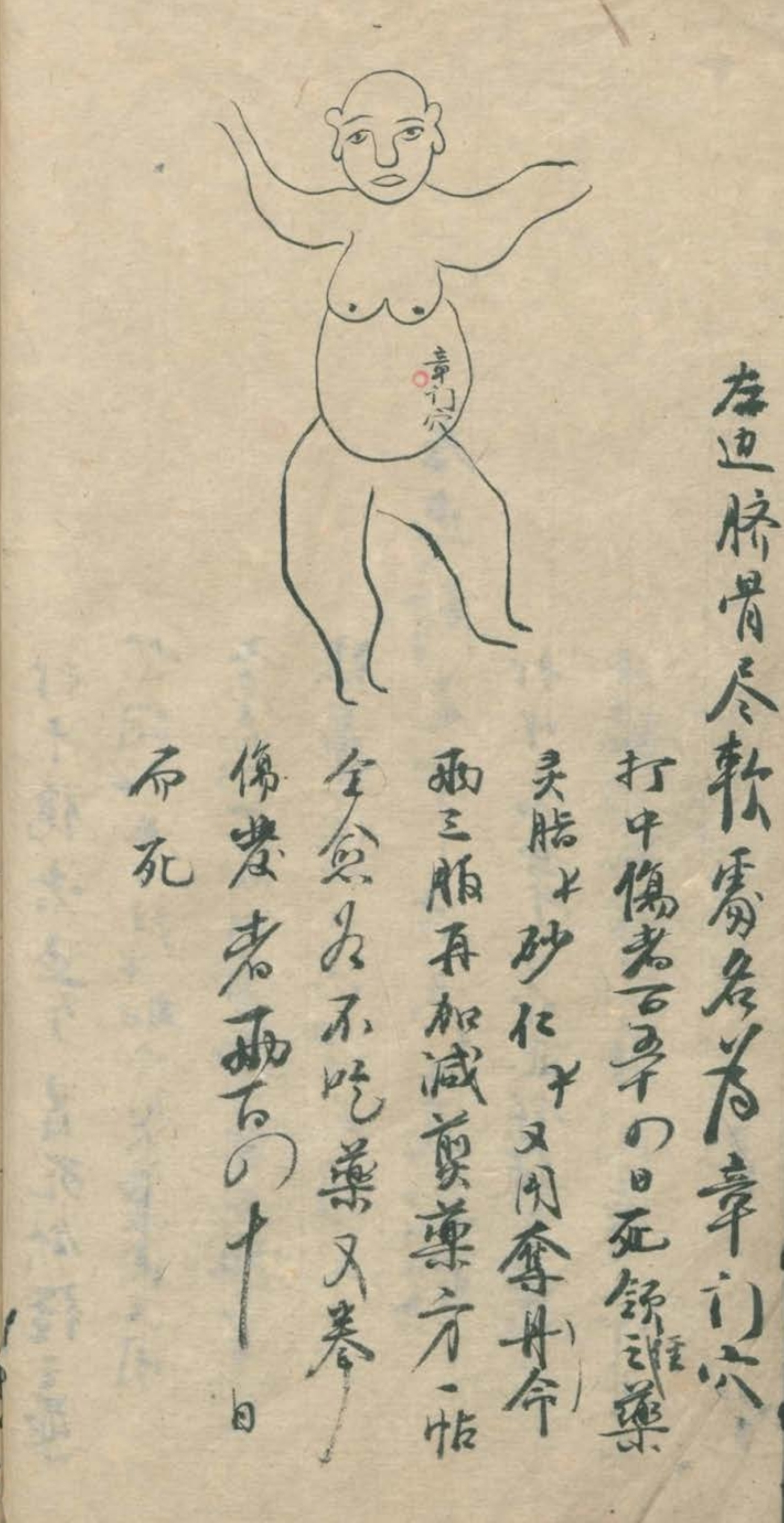 最实用的跌打药方,祖传跌打秘方100首