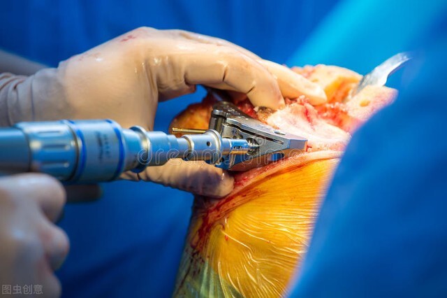 人工膝关节置换手术过程要多久,人工膝关节置换术后三个月