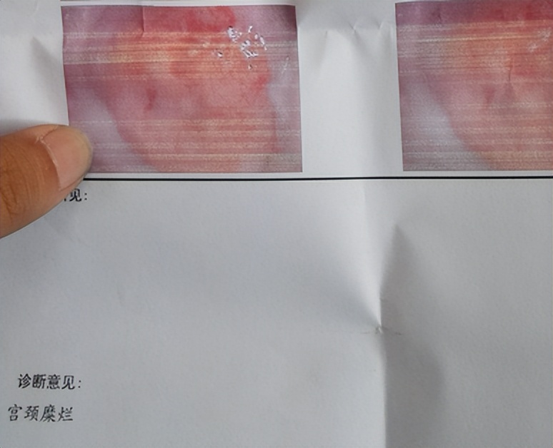 女子下身检查疼痛难忍,女孩腹痛到医院检查惊呆了