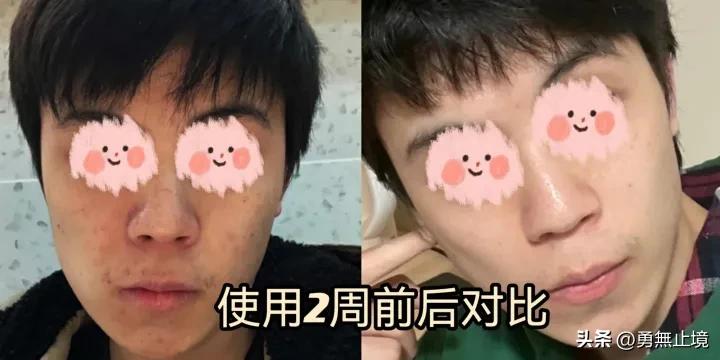 男士用什么洗面奶控油祛痘效果好,洗面奶男士控油祛痘印祛黑头推荐