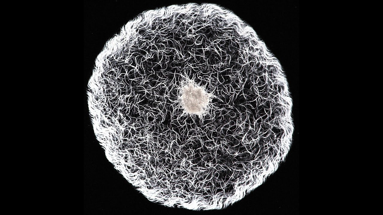 醋里面长出了一团肥肉,醋里长的肥肉