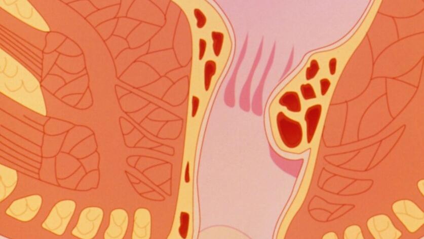 肛裂痔疮引起的便血什么样,痔疮便血跟肛裂便血的区别