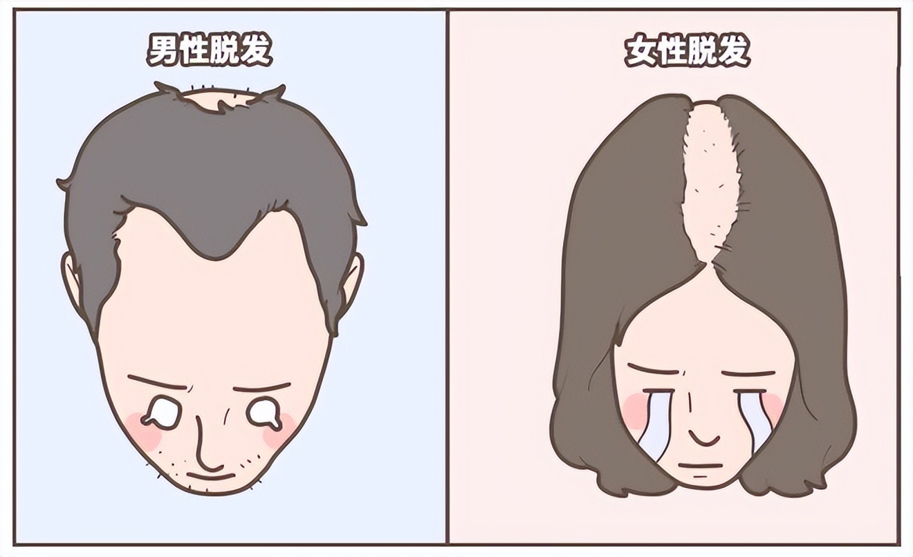 脱发去看医生开什么药,目前脱发最好的药