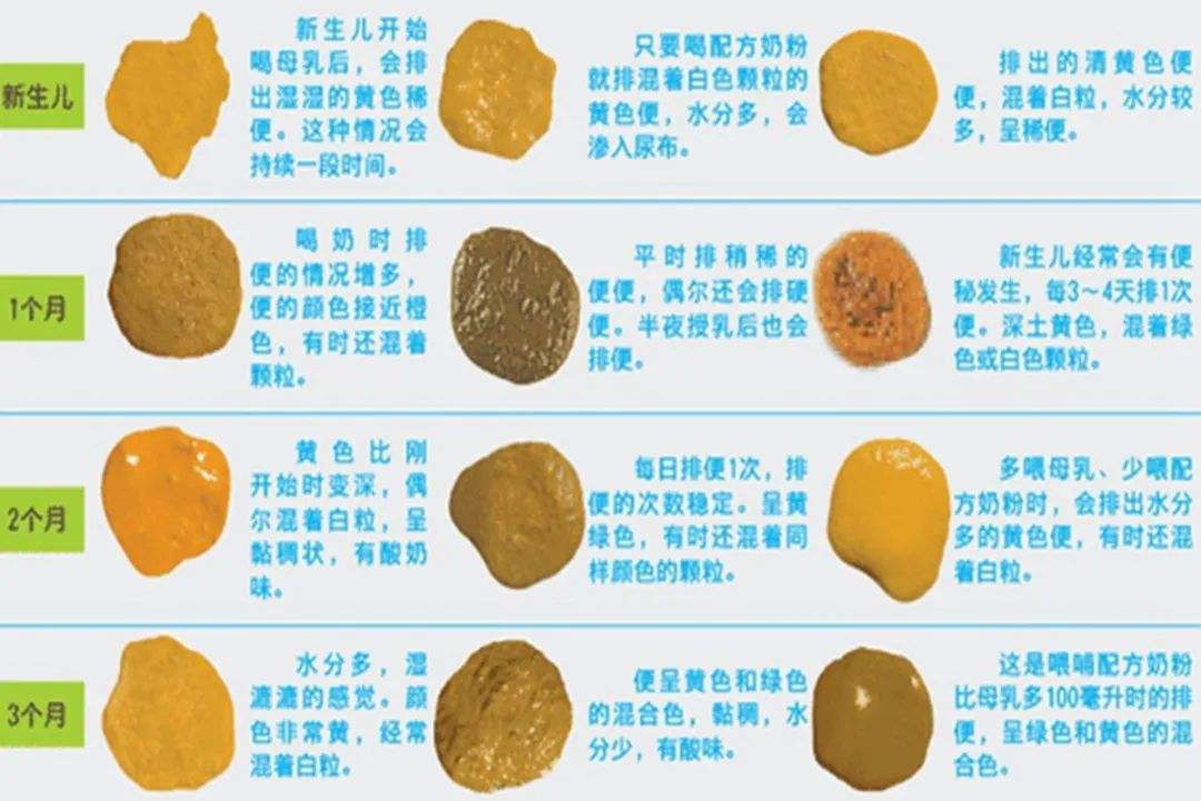 怎样区分宝宝便便是正常便,15种异常便便