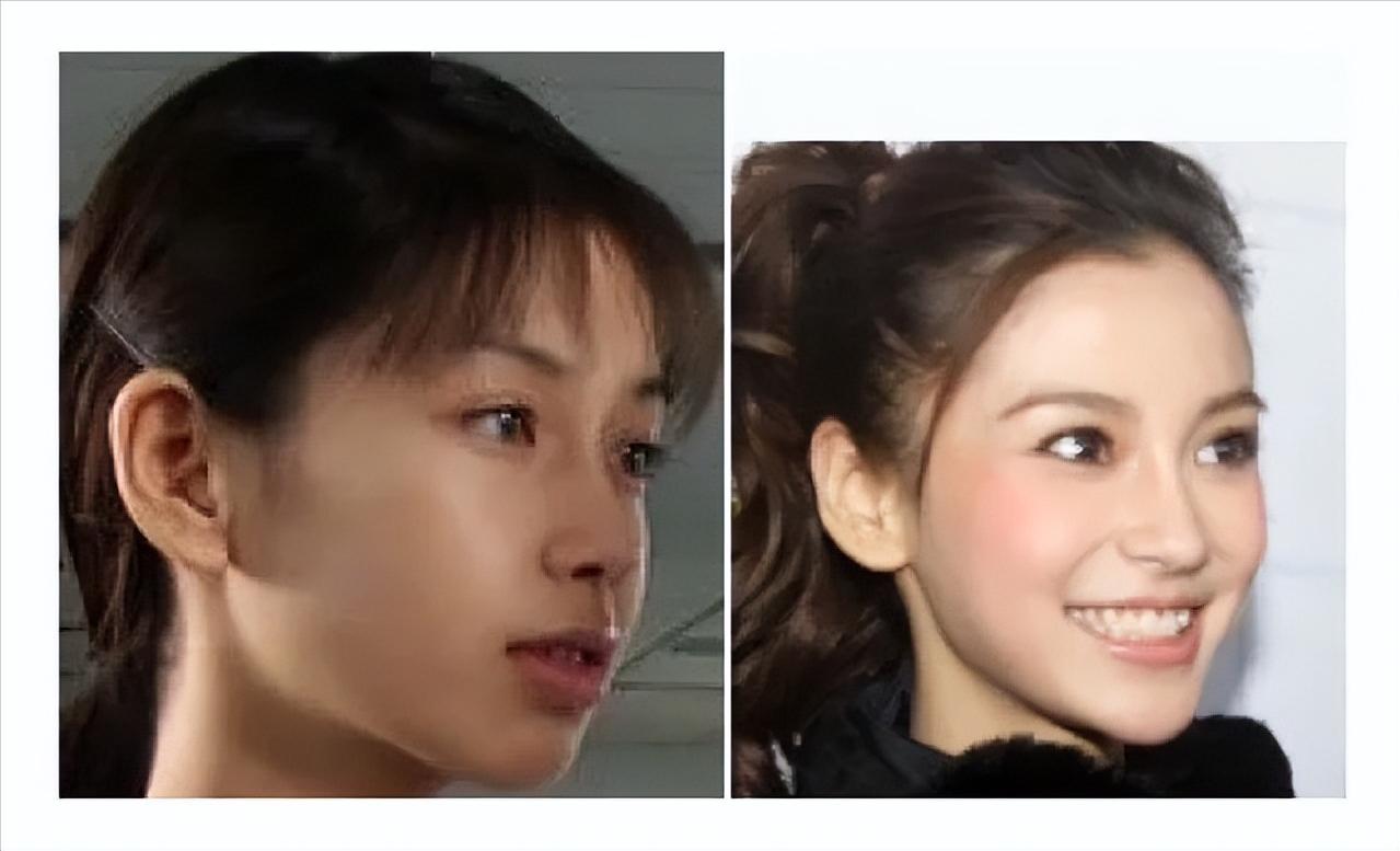 怎么不整容就能成为小v脸,不用整容也能变v脸吗