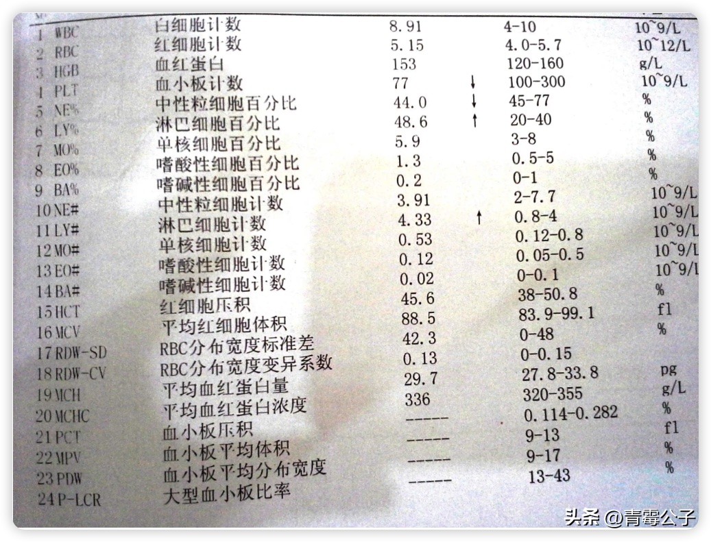 淋巴细胞和b细胞的关系,b淋巴细胞又称为