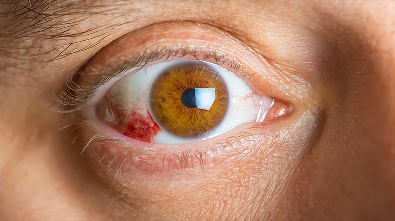 走近中医揭秘健康秘笈,中医甲状腺疾病科普