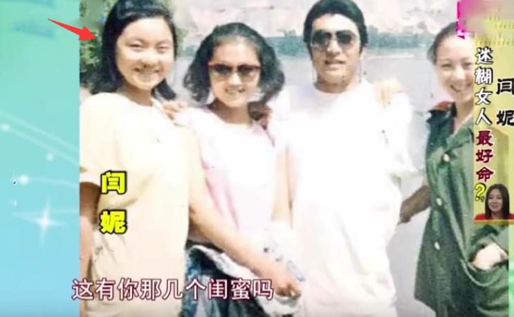 女子割双眼皮失败像瞪眼,女明星割双眼皮对比照