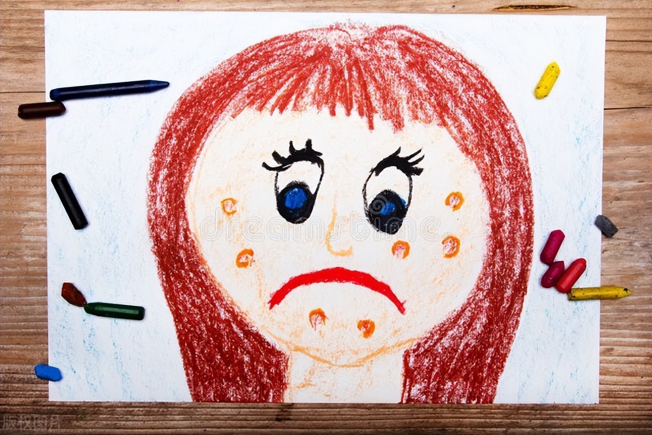 湿疹过敏引起皮肤发红怎么办,治疗湿疹过敏的药有哪些