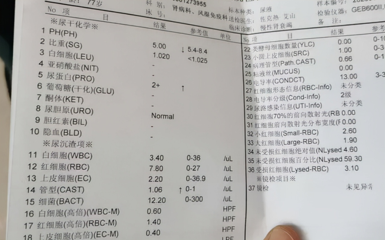 尿蛋白高是什么原因造成的肾病,糖尿病肾病如何降低尿蛋白的水平