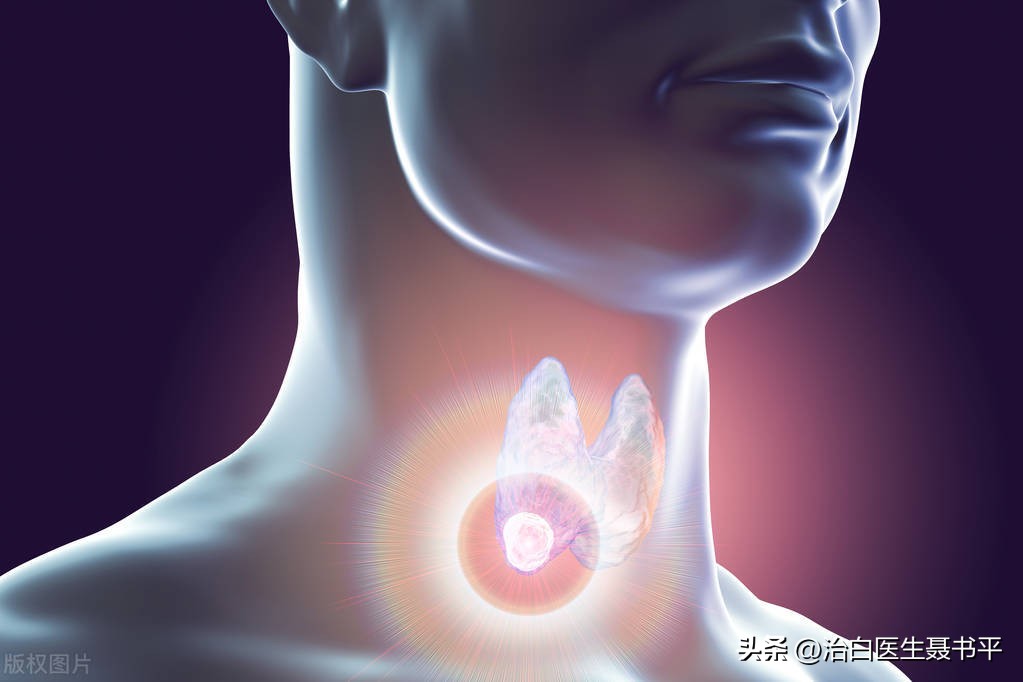 甲状腺结节引起的白癜风,甲状腺结节和白癜风有关系吗