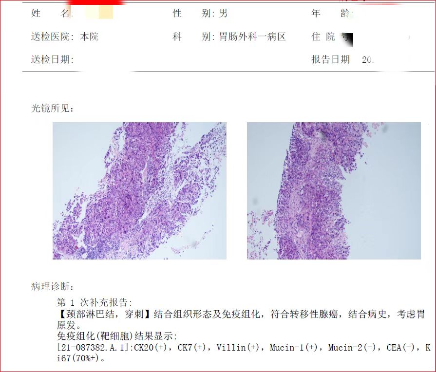 助力癌症康复,胃癌晚期转化治疗成功案例