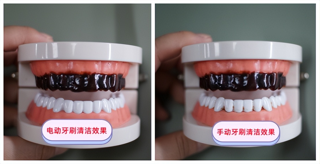 儿童电动牙刷有没有危害？五类伤牙坑货不要选