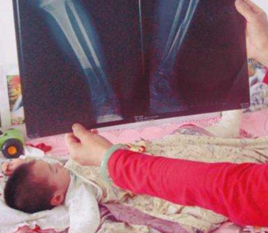 河南侏儒女孩靠短视频吸粉600万，嫁1米8丈夫后遭抛弃，如今怎样