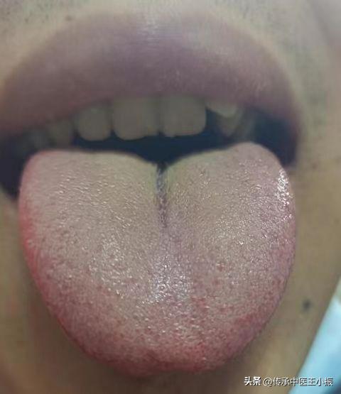 知柏地黄丸吃了真的有用吗,知柏地黄丸可以吃多久才有效