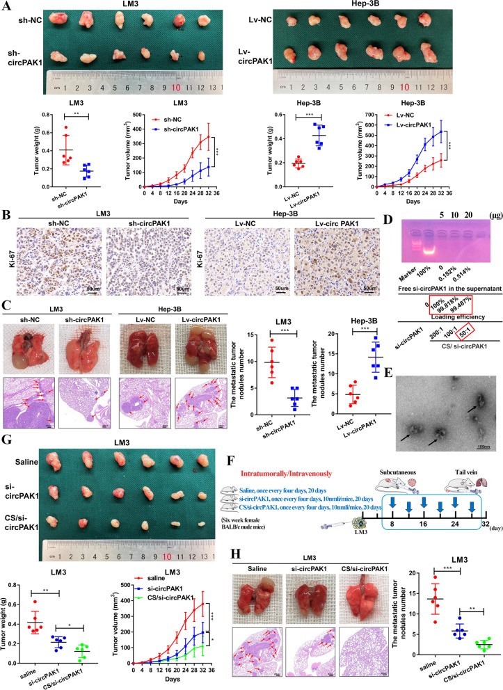 CircPAK1与14-3-3ζ相互作用,调节YAP核定位促进肝细胞癌进展