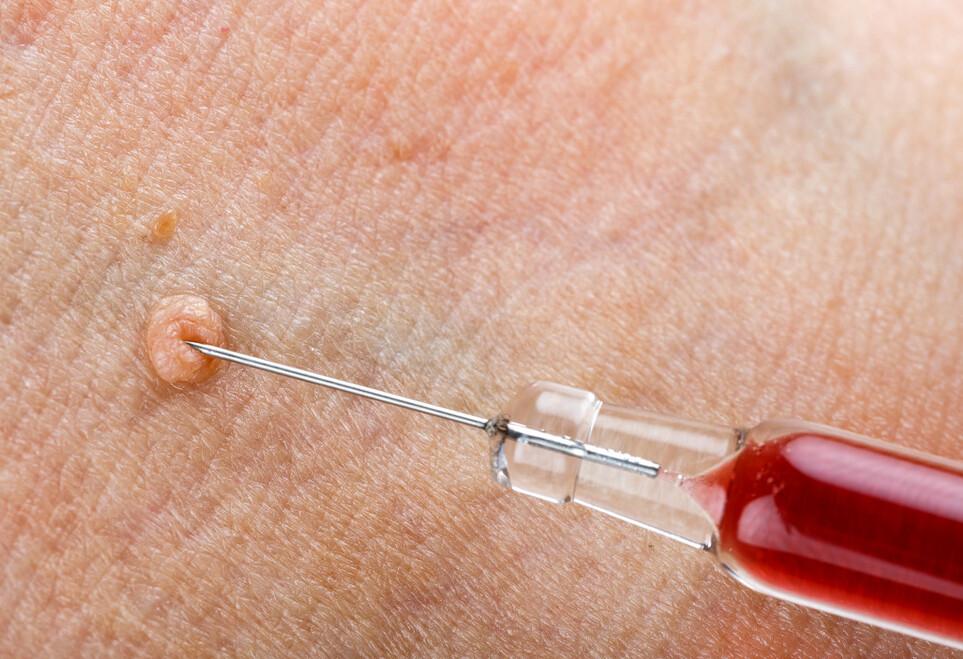 能通过性传播的疾病有哪些,7种疾病会传播