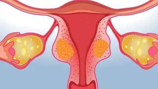 女的摘掉子宫和乳腺有什么影响,女性摘掉子宫会显老吗