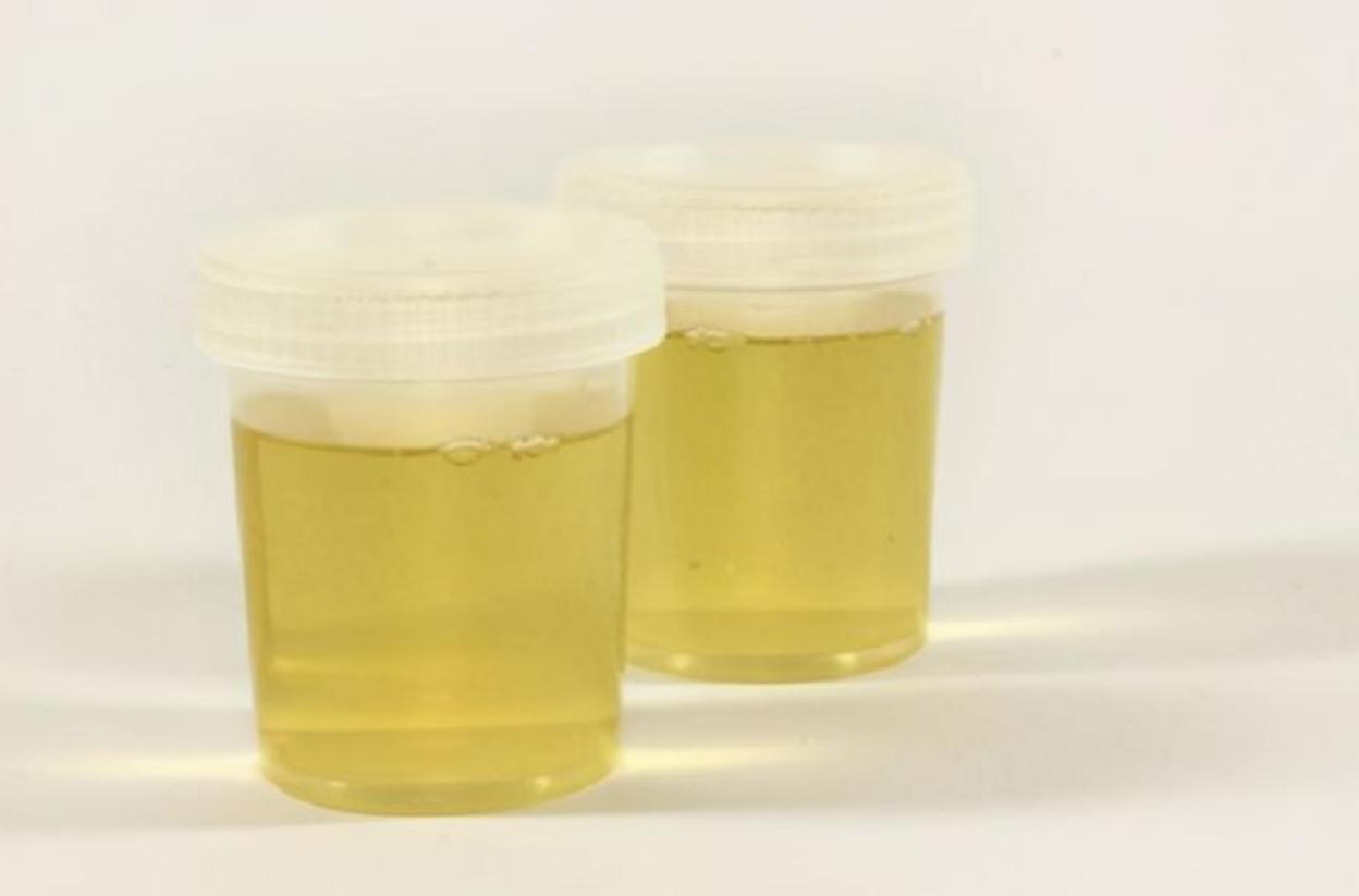 亨尼格·布兰德：为了提炼黄金，煮干了5000升尿液，结果如何？