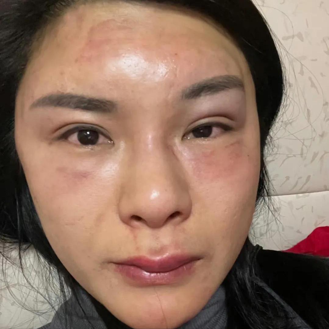 砍杀狗事件处罚,家暴杀狗事件