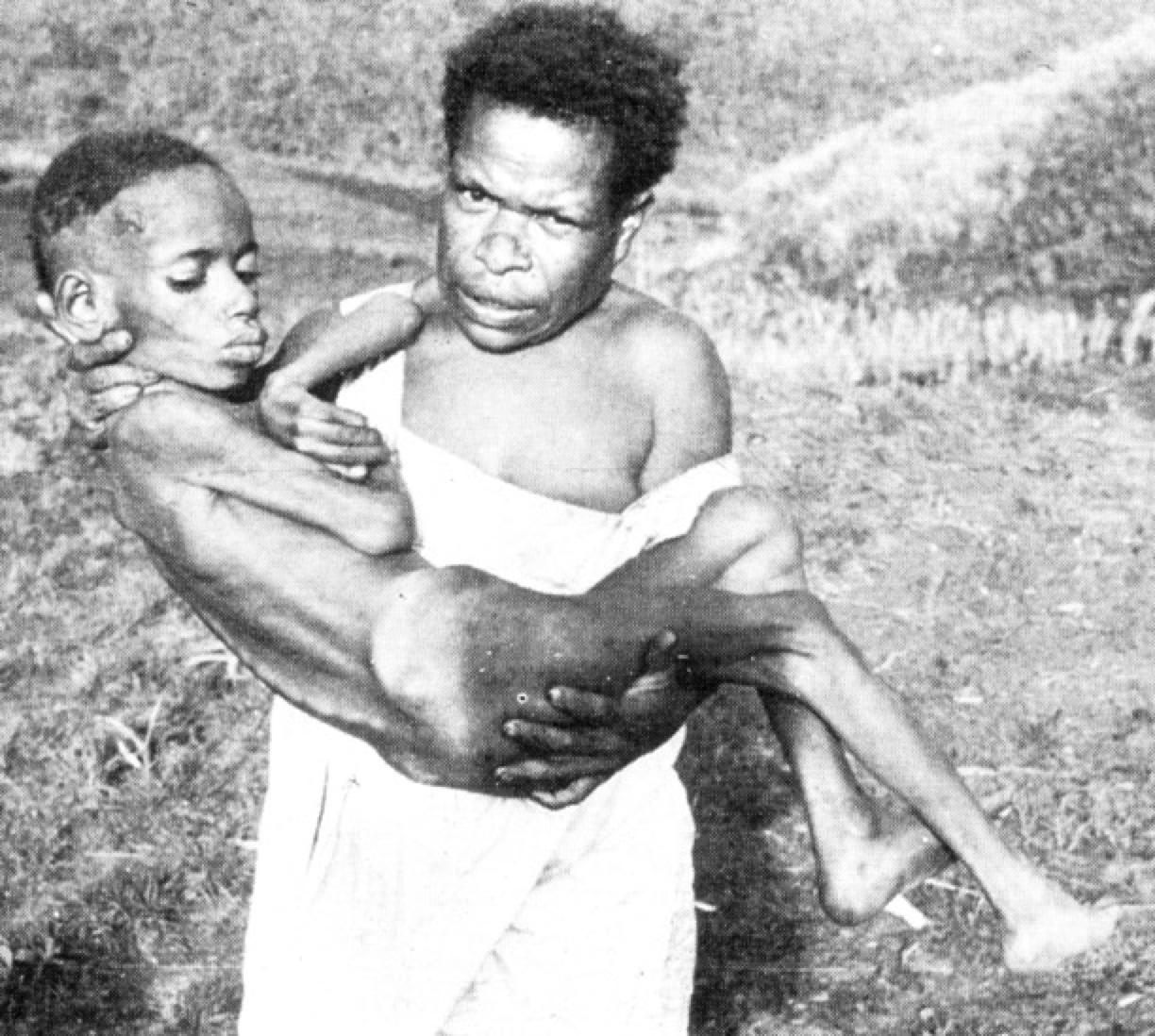 感染无药可救？烹煮杀不死的朊病毒，是上帝刻在基因的“禁令”？