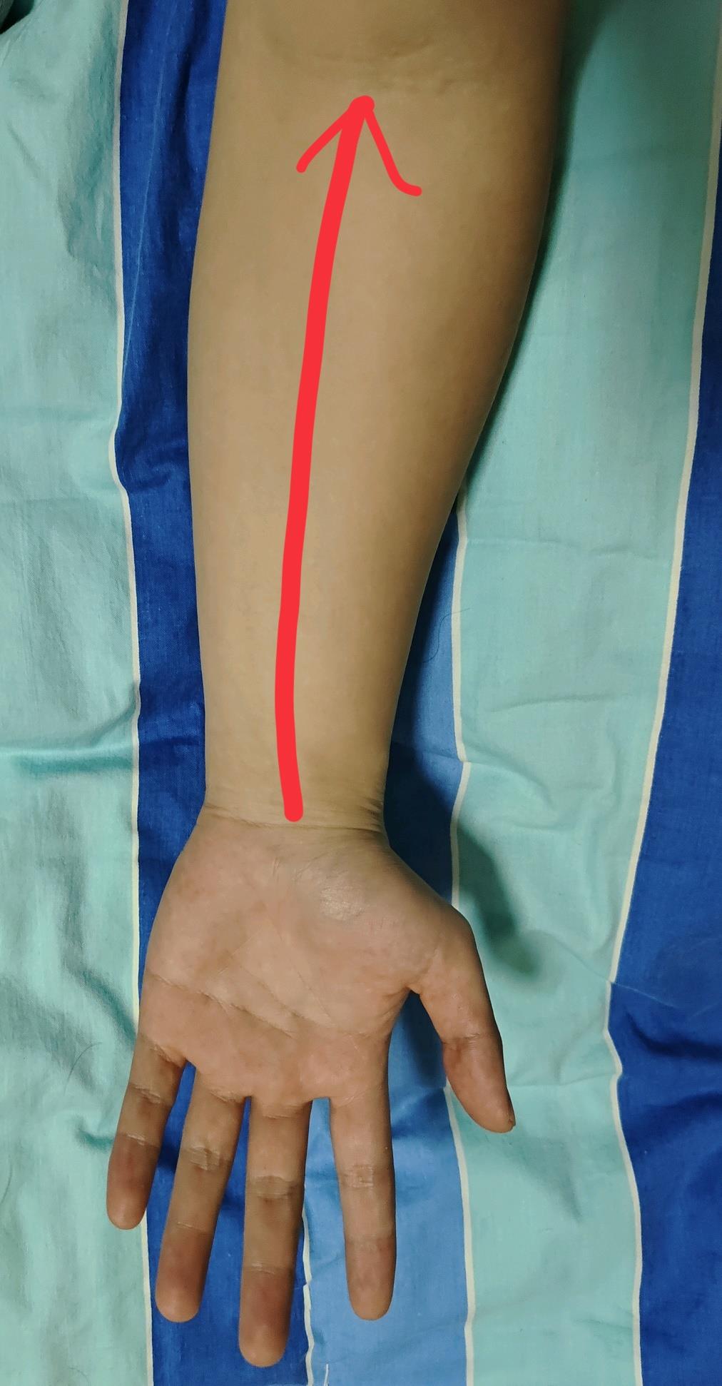 宝宝便秘拉的便便有粘液,宝宝便秘拉绿色的便便是什么原因