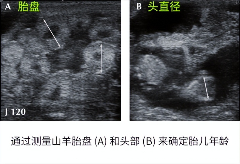 b超检测羊孕方法,怀孕羊b超图像