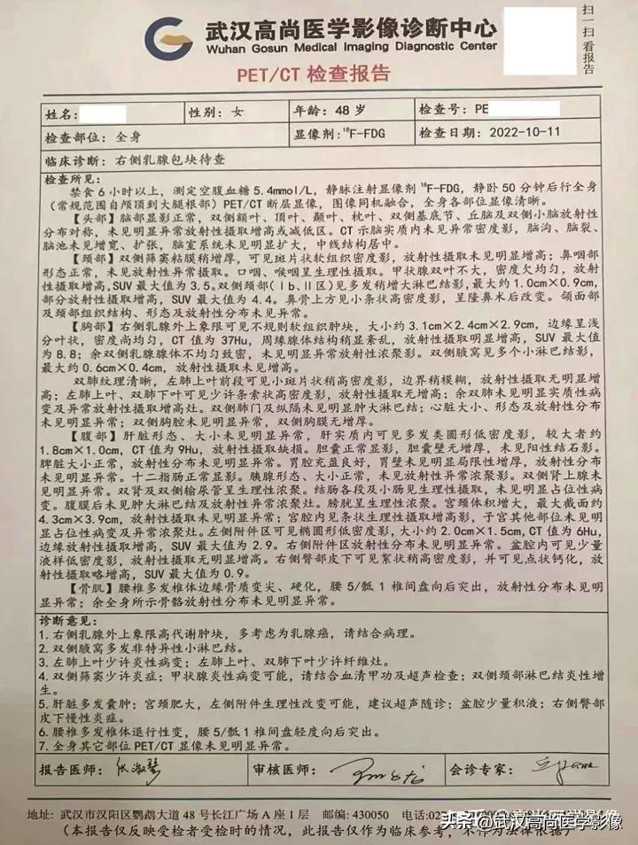 乳腺超声病例,乳腺肿块巨大超声结果4a