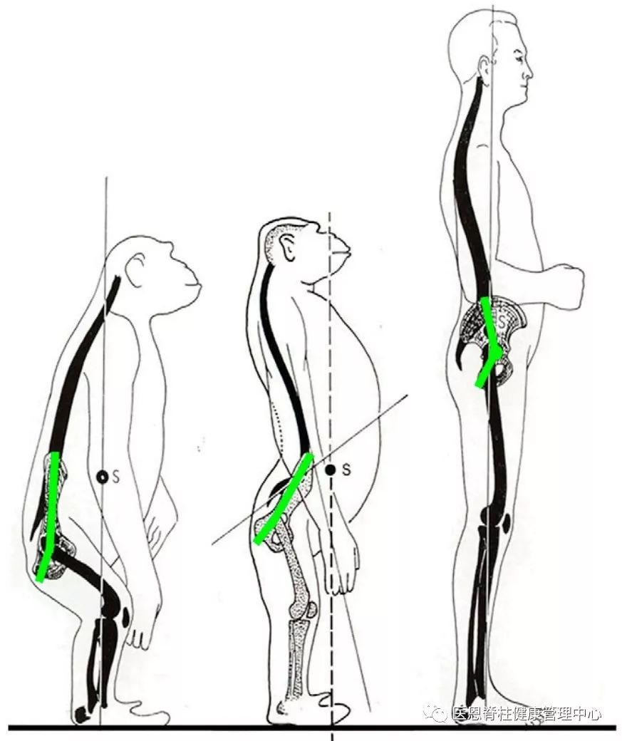 腰椎生理前凸消失是什么意思,颈椎间盘向后局限性突出