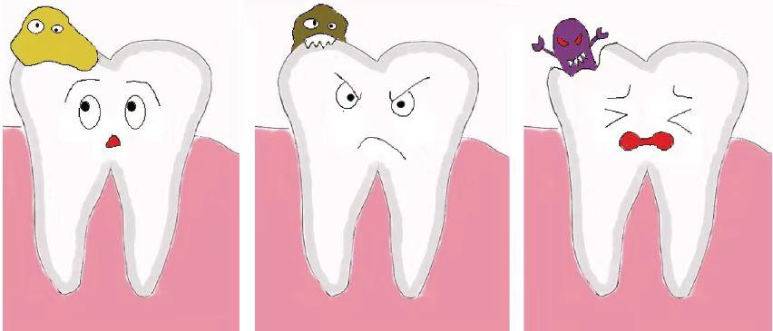 牙坏了必须拔掉吗,坏牙要不要拔