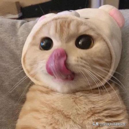 冬天孩子经常舔嘴唇涂抹清凉油,天气干燥小孩舔嘴巴