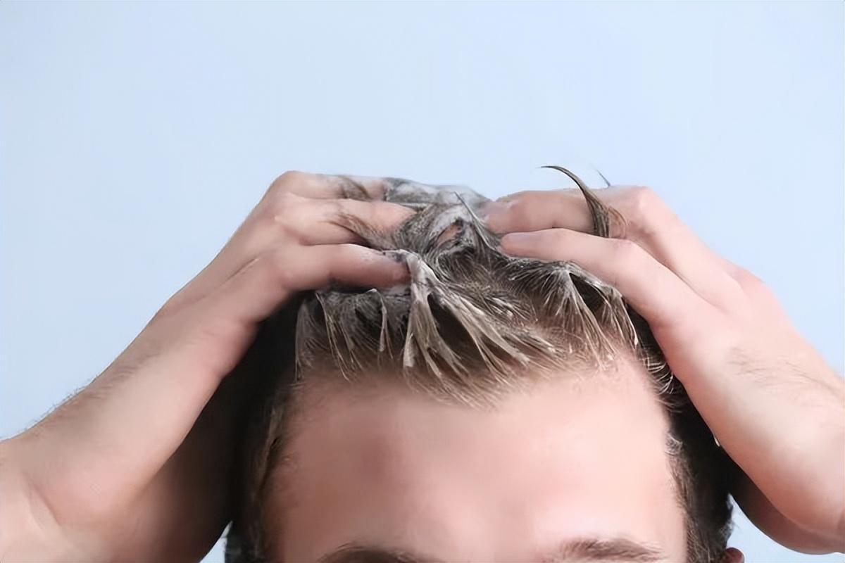 治疗头屑脱发最有效的办法,头屑头痒脱发治疗方法