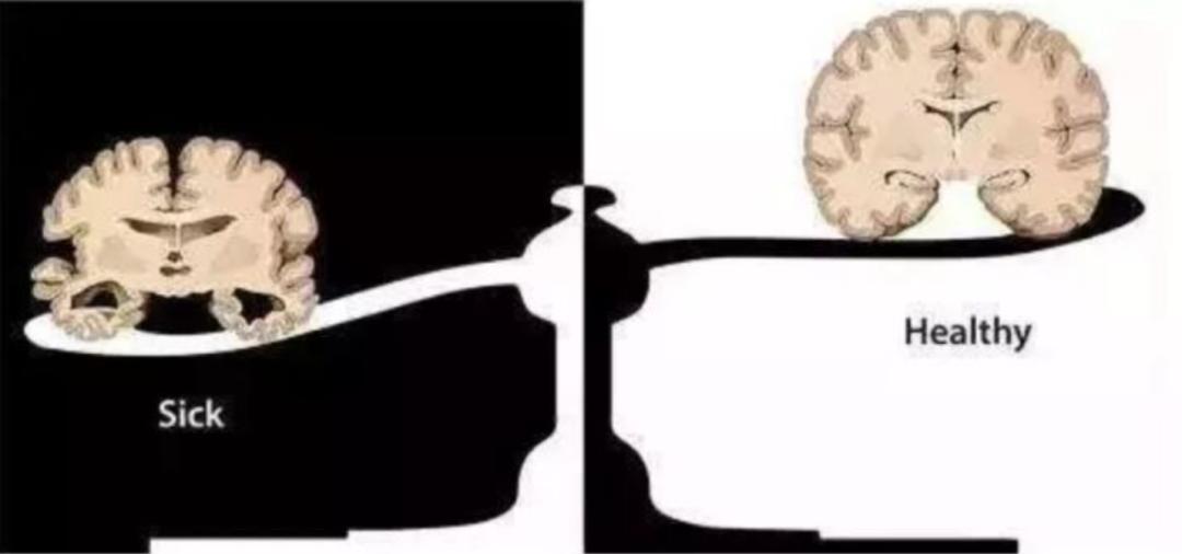 最可怕的朊病毒是什么,世界上最可怕的朊病毒