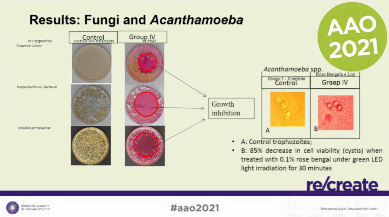 角膜炎症的基本病理过程,角膜炎治疗最新研究