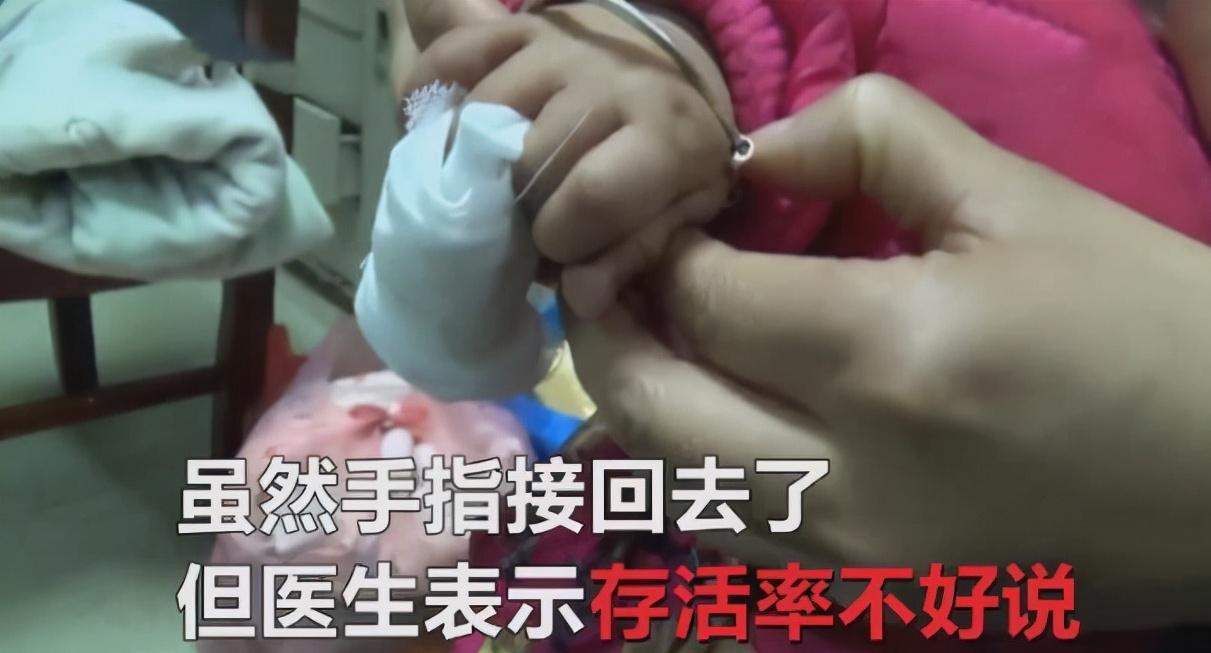 兔子为什么咬小孩的手指,兔子咬断11个月大小孩手指