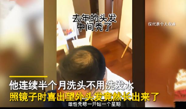 脱发严重应该多洗头还是少洗头,长时间不洗头导致的脱发怎么改善