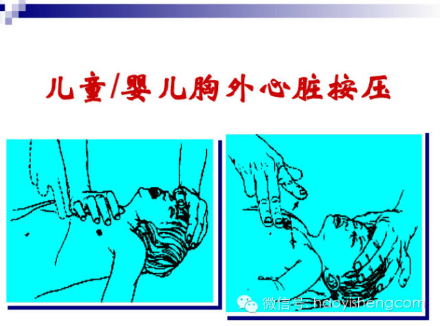 心肺复苏ppt课件免费下载,新生儿心肺复苏ppt课件