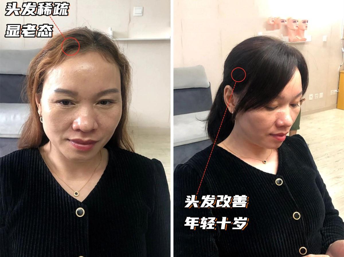 头发的长短稀疏决定衰老的速度,头发稀少又白让人一下子老了几岁