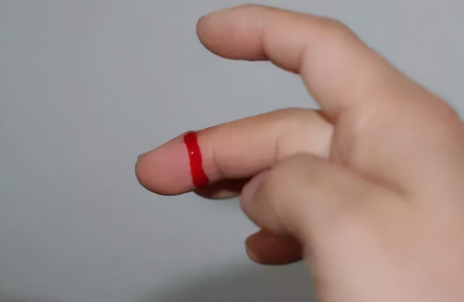 孩子磕碰到怎么安慰,小孩子划伤后有痕怎么处理