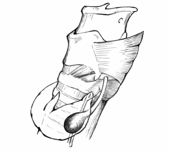 耳鼻喉科田家军,咽喉科田家军