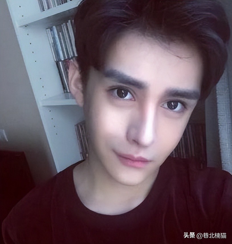 明星嘴突戴牙套前后对比,明星和假牙