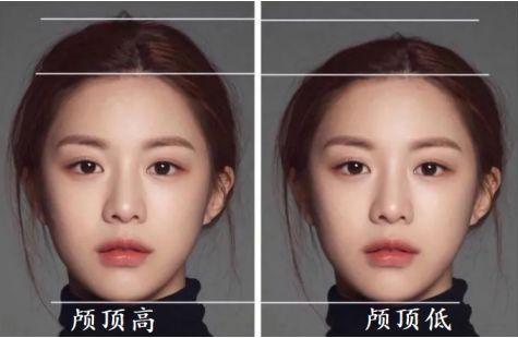 颅顶高发际线低怎么办,颅顶低降低发际线