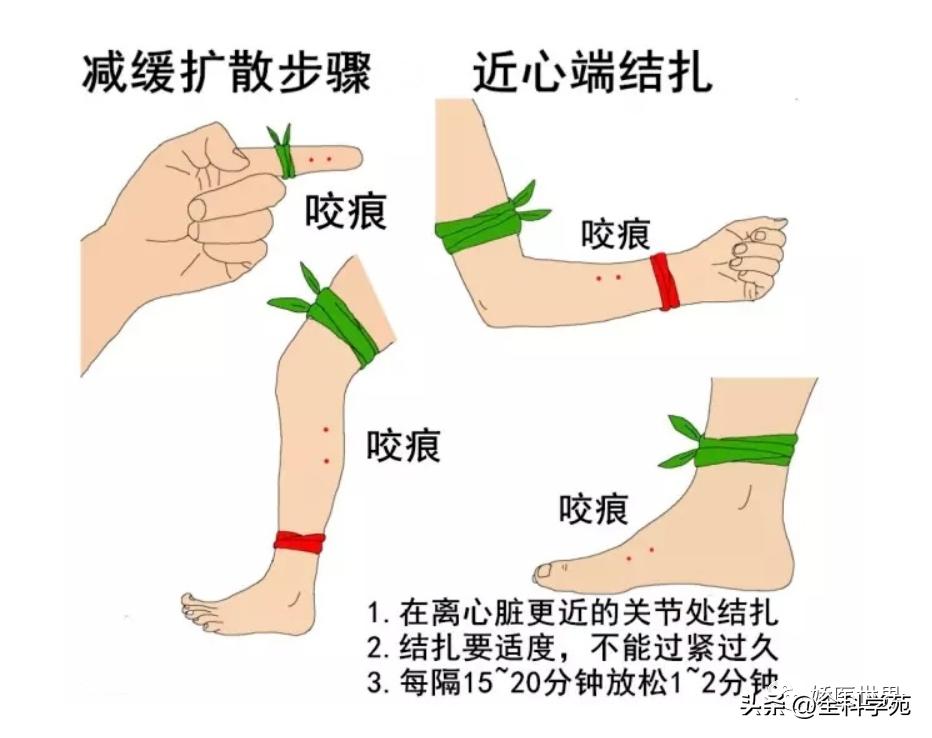 烧伤烫伤防护与急救知识英文,烧伤冻伤如何处理