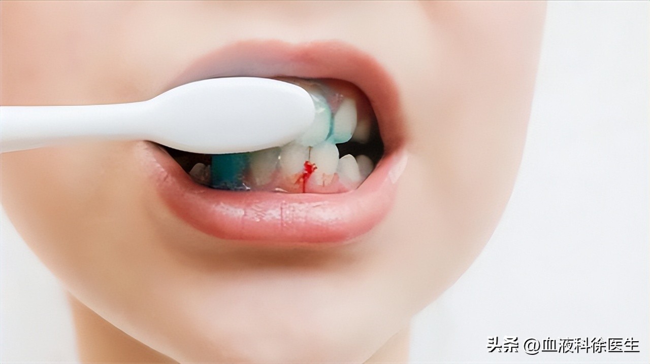 血友病：常被误认为“白血病”，血友病的症状有哪些？