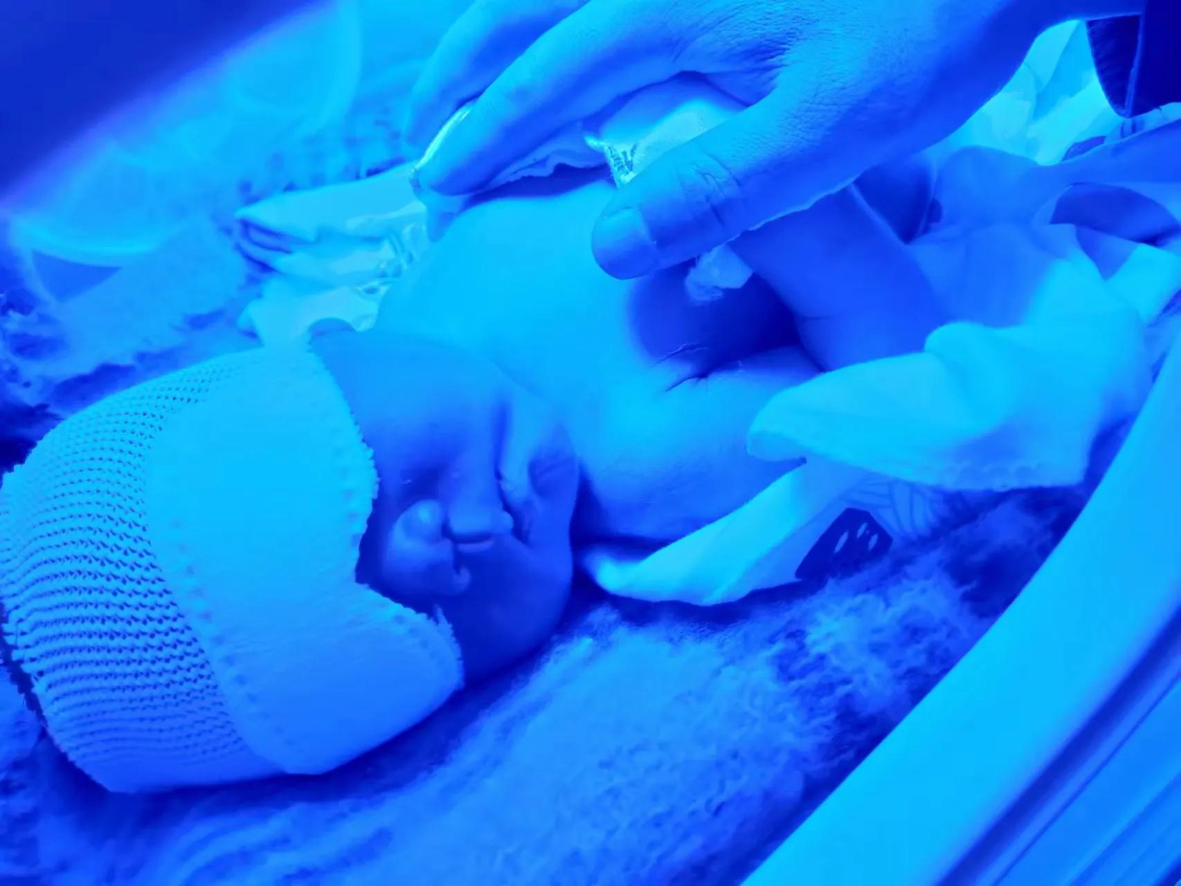 黄疸肝炎需要住院治疗吗,病理性黄疸必须住院治疗吗