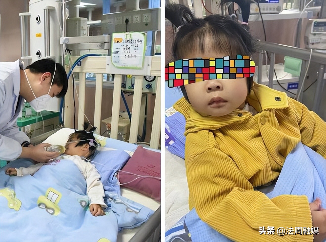 儿童吃花生卡气管死亡,小孩去吃坚果卡住医生接力急救