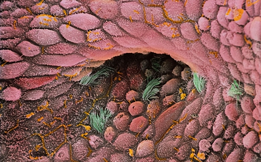 日本妇科病为什么少,日本女性妇科病