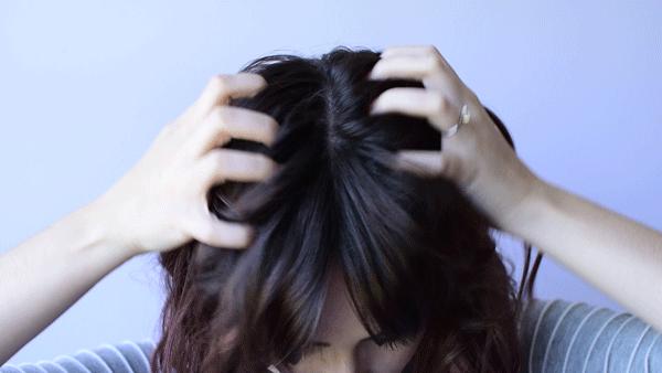 脱发跟头屑的关系,脱发和头屑的关系