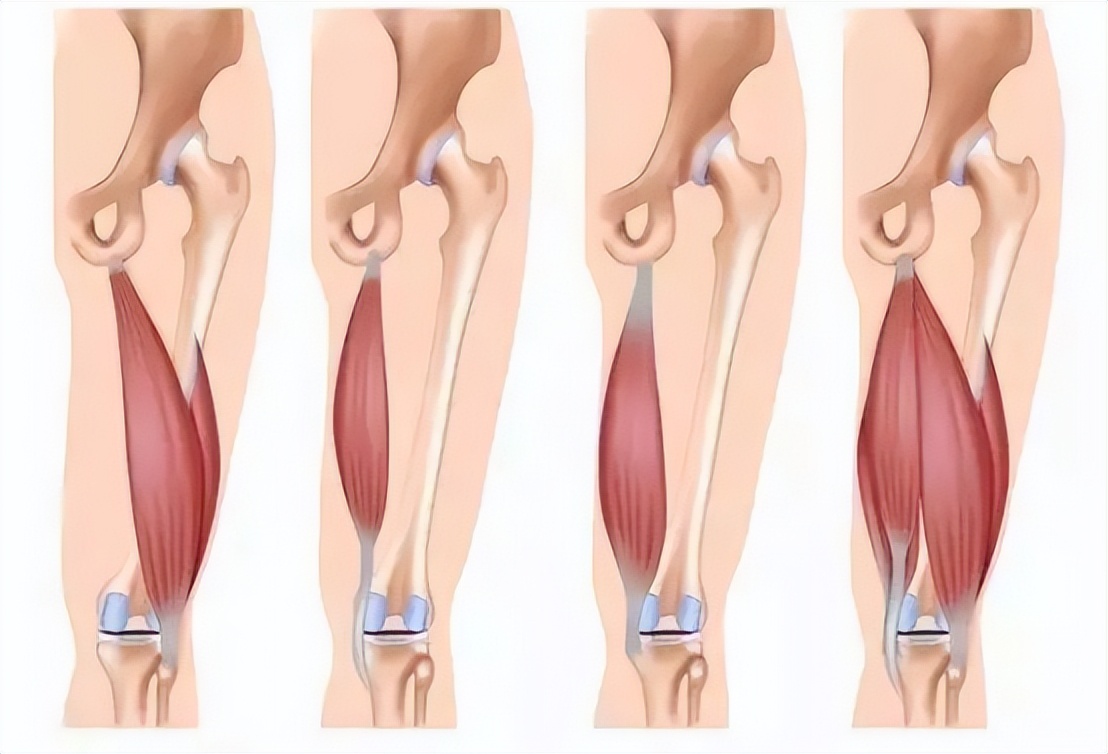 筋膜枪海博艾斯哪款最好,专业级筋膜枪海博艾丝
