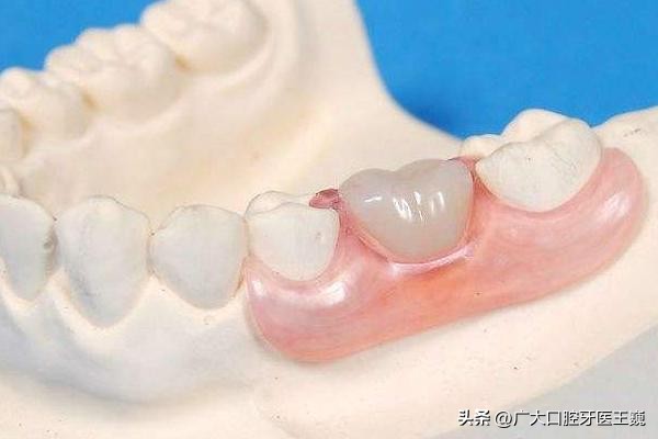 牙龈出血是什么原因牙龈大量出血,牙龈出血的原因和治疗方法是什么